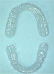 図1：個人の歯列に適合したリテーナーを作製